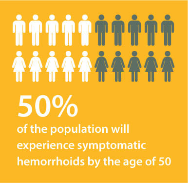 50% of the population will experience symptomatic hemorrhoids by the age of 50
