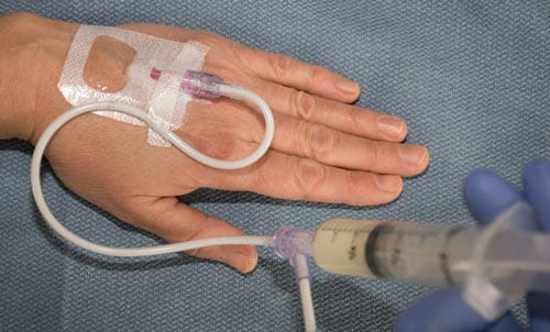 digestive health associates support propofol sedation